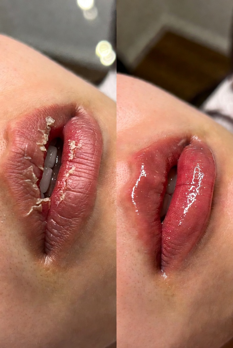 Bác sĩ Mỹ Dung