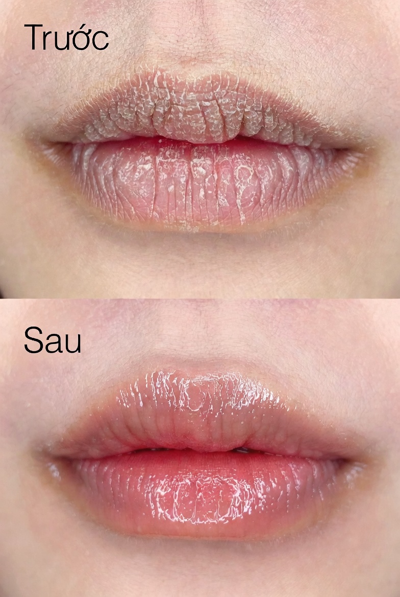 Trước sau 29 ngày